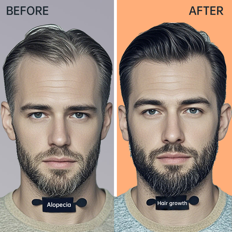 AIDEVI Biotin Hair Nail & Skin Support Supplement -AIDEVI