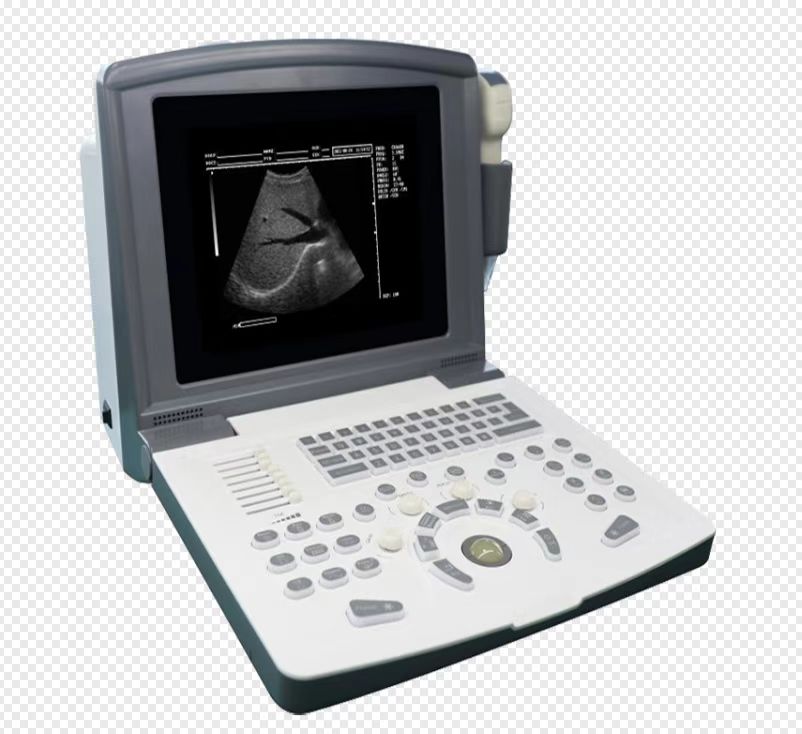 Portable Black and White Laptop Ultrasound System with 2 transducers for Abdomen ,OB.Gyn, Small orgen ,Vascular, Cardiaovascular