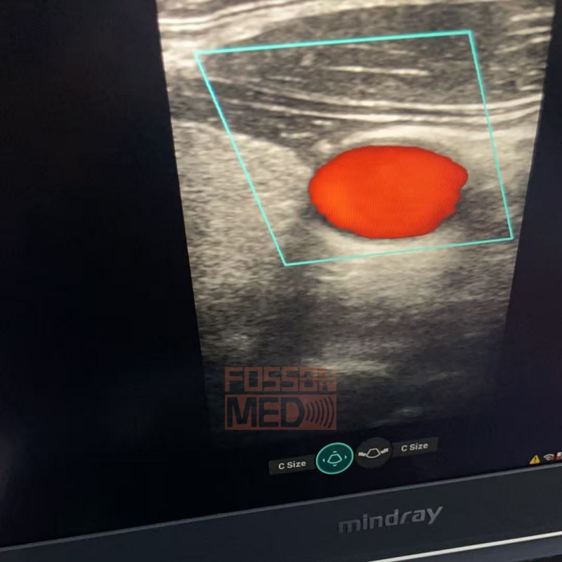 Original Used Mindray L16-4HS Hocky Sticky Linear Array Ultrasound Transducer probe for Mindray MX7, M8 ,TEX , M9 premium , Resona i9 , TE7ACE , M8 Elite , M9 , ME8 , M9 vet , Consona N9 , Resona I9 Elite , TE9 , Consona N8 , Consona N7