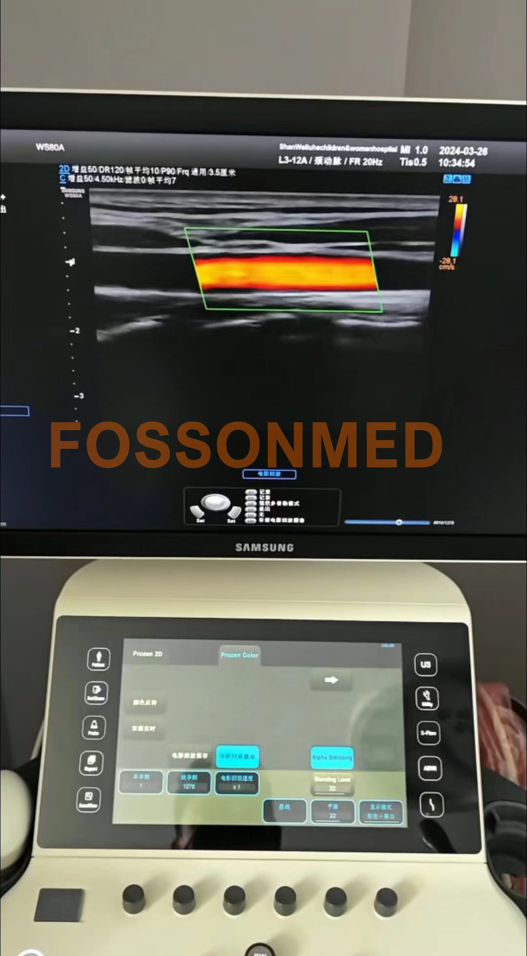 Original Used Samsung Medison L3-12A Linear Array Ultrasound Transducer for HS 70A/WS80A/Hera W10/W10elite/W9/RS85