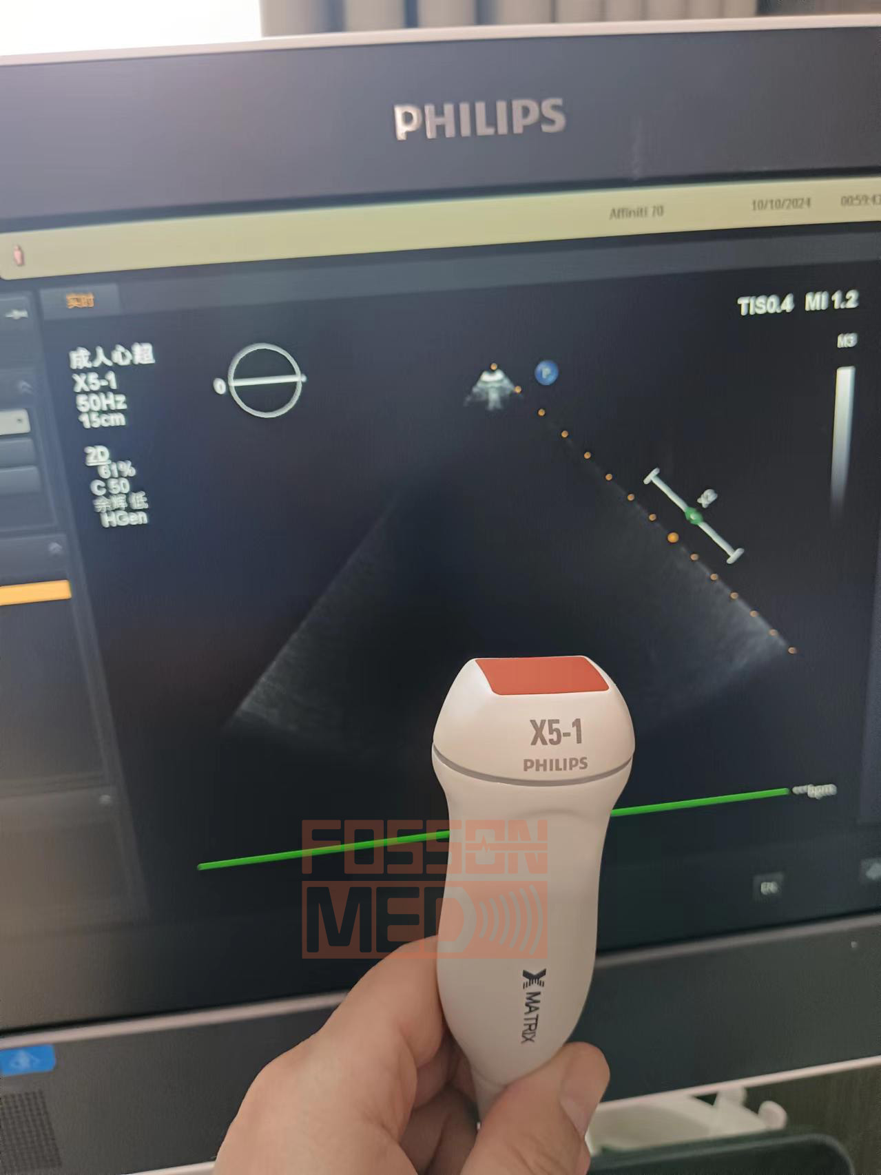 Philips X5-1 Ultrasound Transducer . Original
