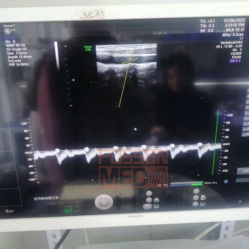 Original Used GE ML6-15-D Linear Array Ultrasound Transducer Probe for Vivid E9.Voluson E8.Voluson E6.Voluson E10.logiq E9.logiq S8.logiq E10.logiq Fortis