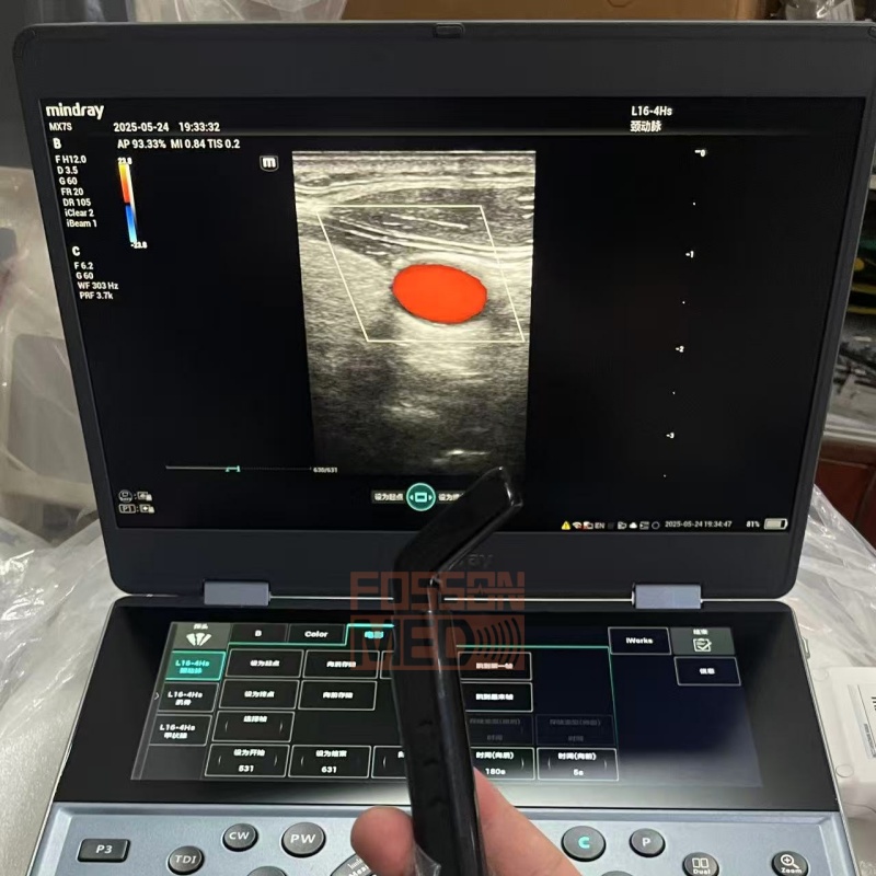 Original Used Mindray L16-4HS Hocky Sticky Linear Array Ultrasound Transducer probe for Mindray MX7, M8 ,TEX , M9 premium , Resona i9 , TE7ACE , M8 Elite , M9 , ME8 , M9 vet , Consona N9 , Resona I9 Elite , TE9 , Consona N8 , Consona N7