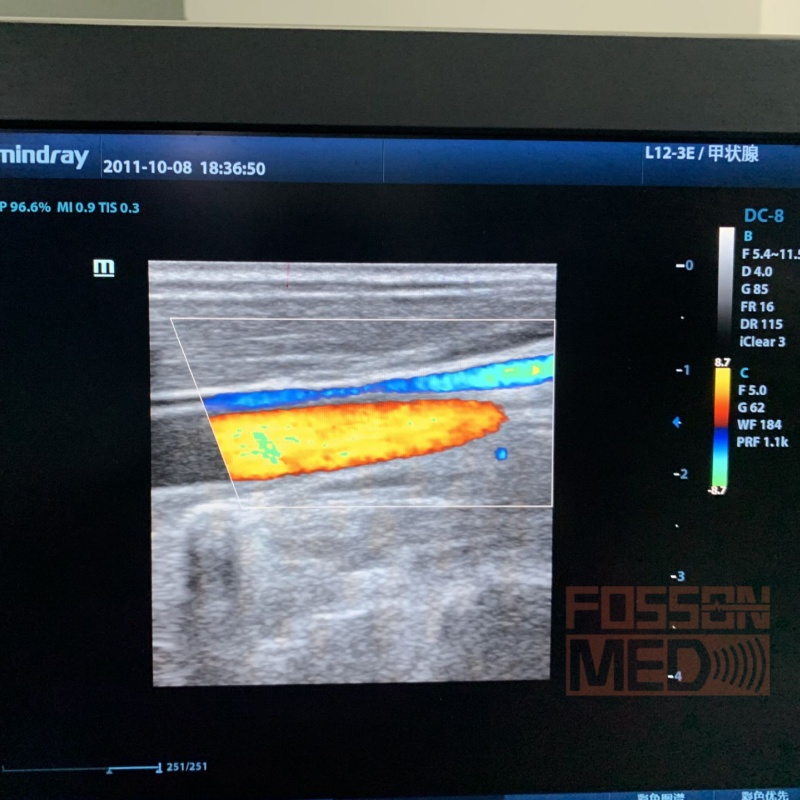  Compatible New Mindray L12-3E linear array Ultrasound Transducer for Mindray DC-8,Mindray DC-8 EXP,Mindray DC-70,Mindray DC-40,Mindray DC-80,Mindray DC-90,Mindray DC-88,Mindray DC-80A