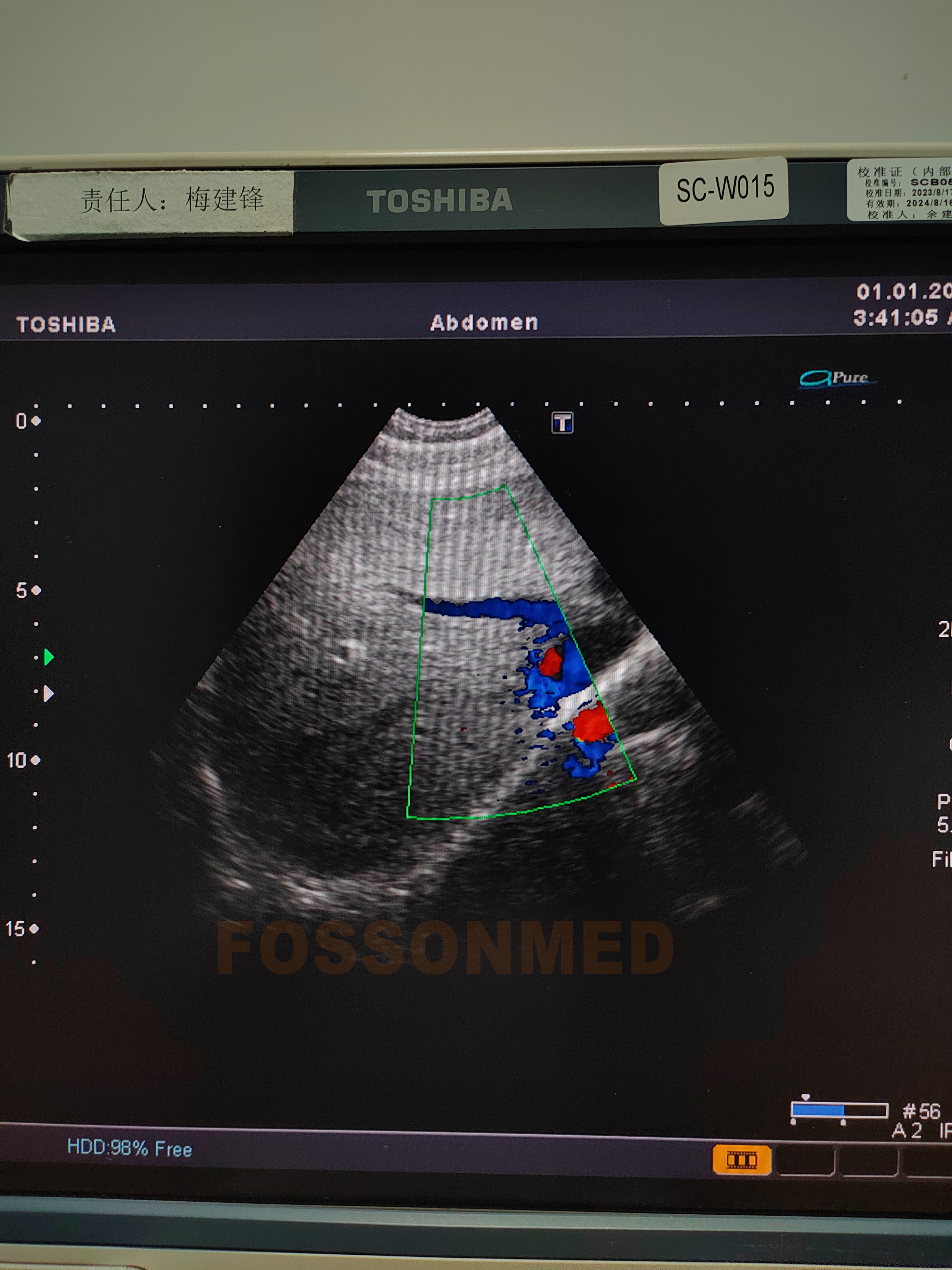 Compatible New PVT-382BT (6MC1) Micro-Convex Ultrasound Transducer for Canon Toshiba Aplio 300 , Aplio 500 , Aplio i600 , Aplio i700 , Aplio i800 , Aplio i900CV , Viamo