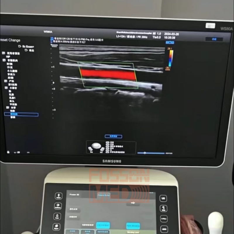 Original Used Samsung L3-12A Linear Array Ultrasound Transducer Probe for HS70A