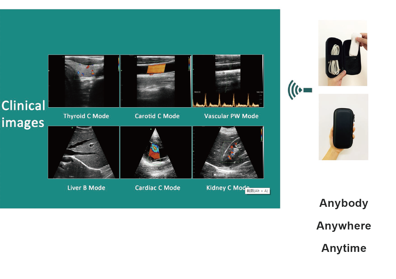 Original New Color Doppler Hand Wireless USB and Wifi 3 in 1 Convex Linear Cardiac Ultrasound Probe / Ultrasound Transducer