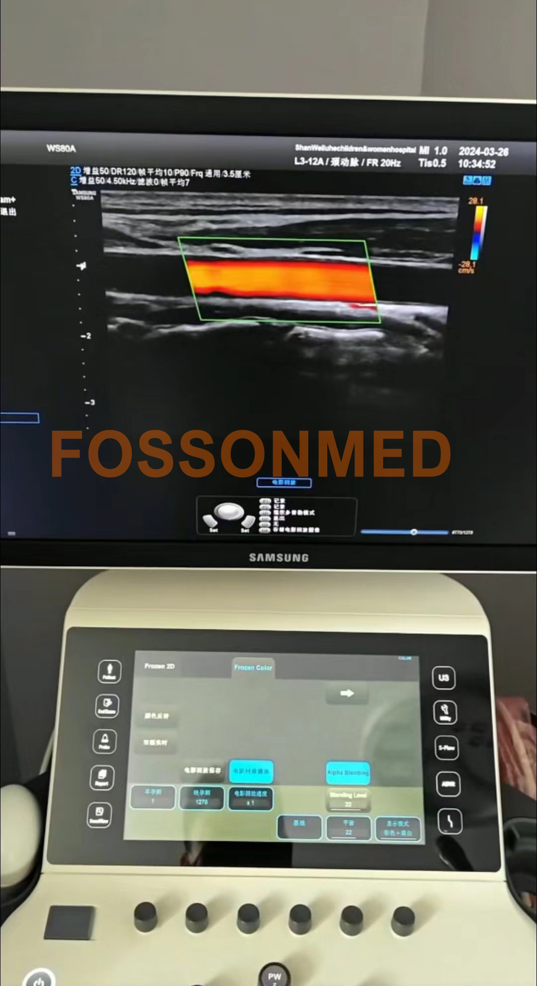 Original Used Samsung Medison L3-12A Linear Array Ultrasound Transducer for HS 70A/WS80A/Hera W10/W10elite/W9/RS85
