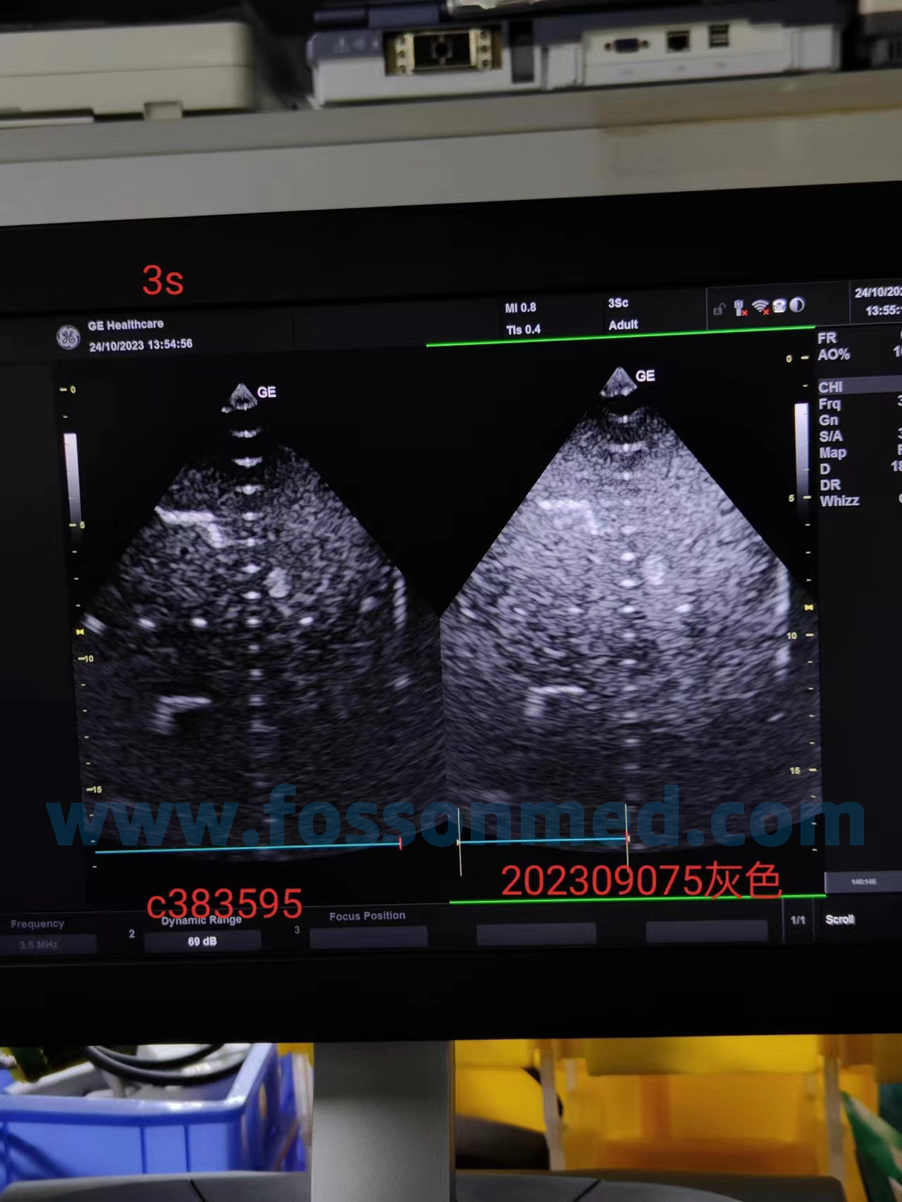Compatible New 3S Cardiac Array Ultrasound Probe for GE Logiq 3 / Logiq 5 / Logiq 7 / Logiq P3 / Logiq P5 / Logiq P6