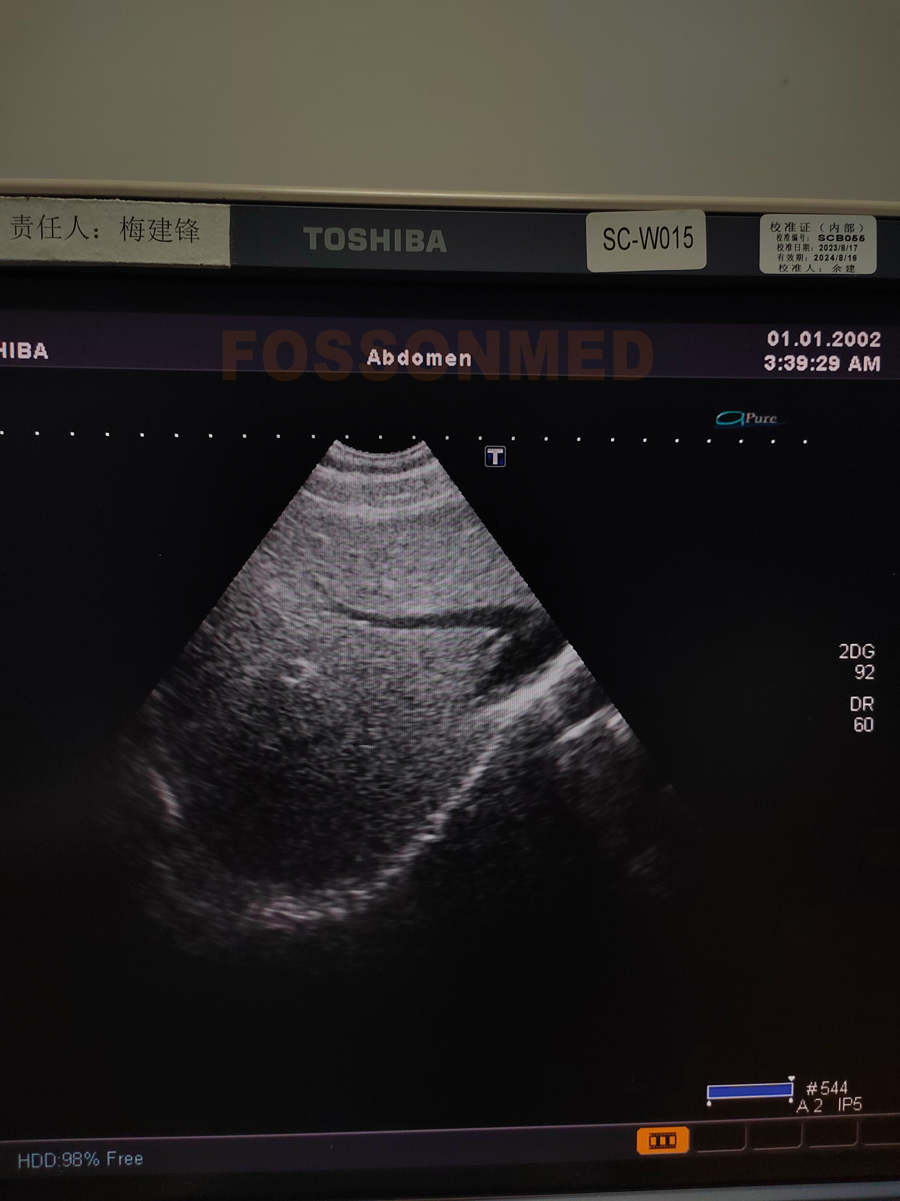 Compatible New PVT-382BT (6MC1) Micro-Convex Ultrasound Transducer for Canon Toshiba Aplio 300 , Aplio 500 , Aplio i600 , Aplio i700 , Aplio i800 , Aplio i900CV , Viamo