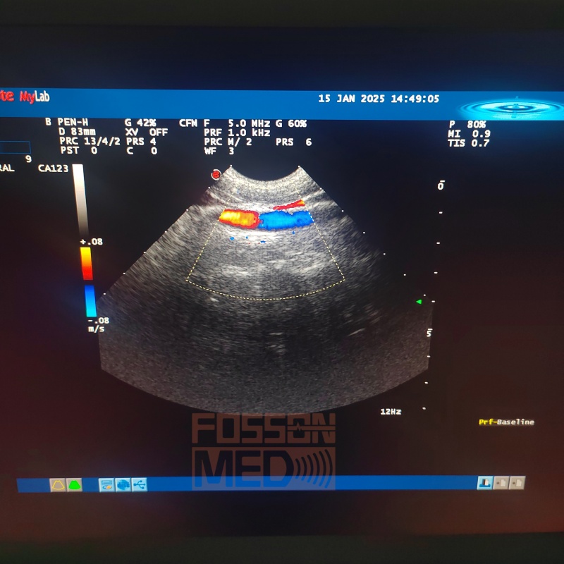 Compatible New Esaote CA123 Convex Ultrasound Probe for Mylab 20 Mylab 25 Mylab 30 Mylab 40 Mylab 70 Mylab 90-FOSSONMED