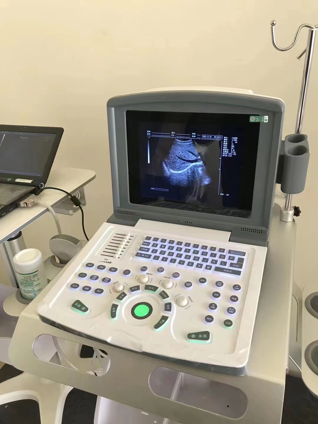 Portable Black and White Laptop Ultrasound System with 2 transducers for Abdomen ,OB.Gyn, Small orgen ,Vascular, Cardiaovascular