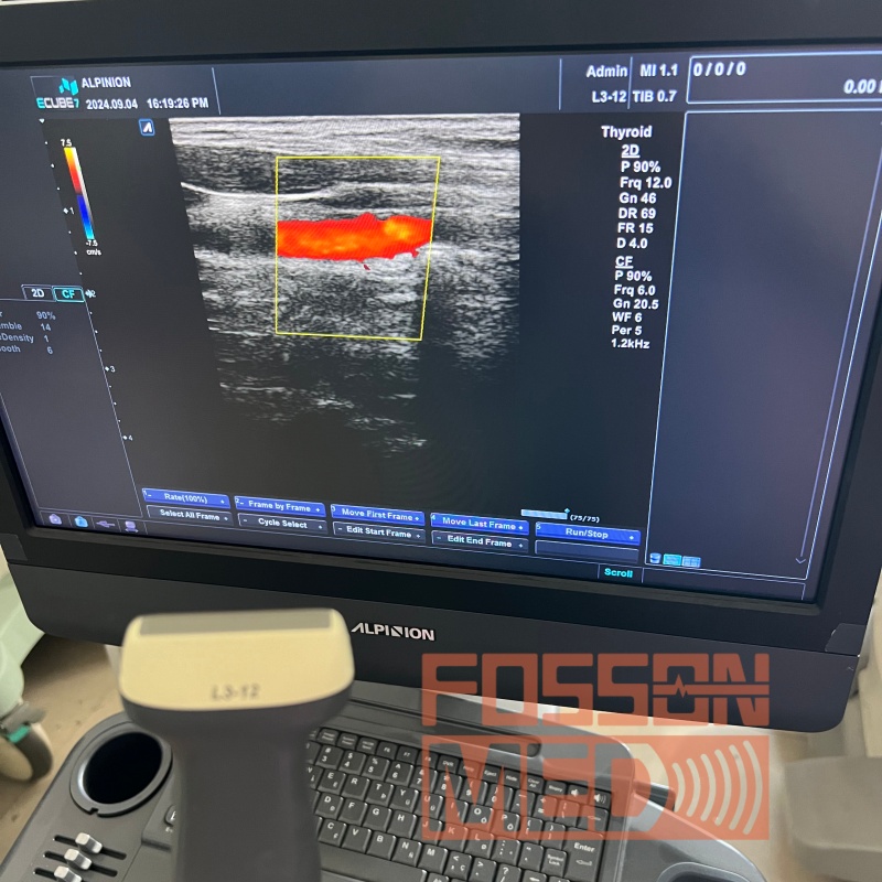 Original Used Alpinion L3-12 Linear Ultrasound Probe for ecube 7 ecube 9