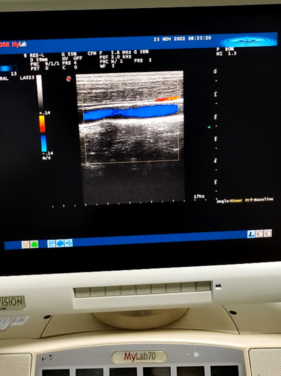 Compatible New LA523 Linear Ultrasound Probe for Esaote Caris Plus / Mylab 15 / Mylab 20 / Mylab 25 / Mylab 30 / Mylab 40 / Mylab 50 / Mylab 60 / Mylab 70XV