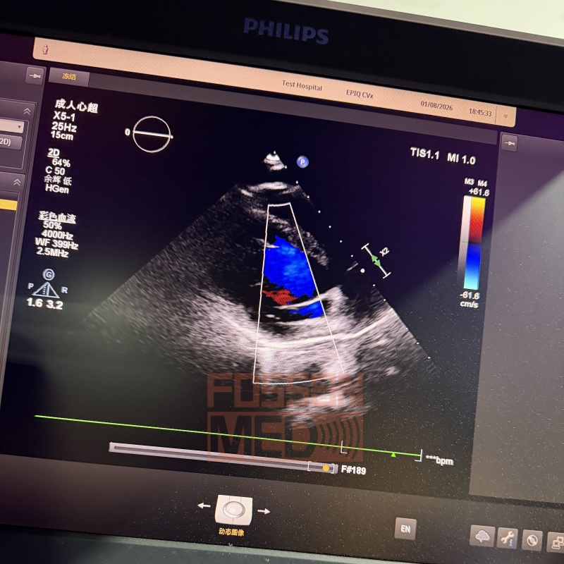 Original Used Philips X5-1 Cardiac Phased Array Ultrasound Transducer Probe for Affiniti 70 EPIQ 5 EPIQ 7 EPIQ 7C EPIQ CVX