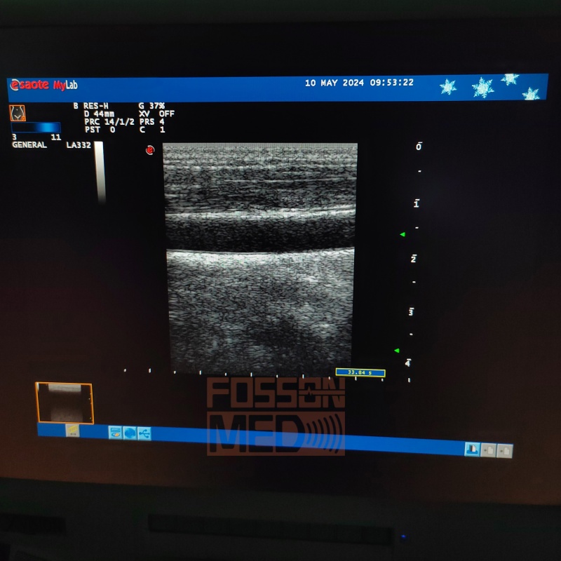 Compatible New Esaote LA332 Linear Ultrasound Probe for mylab 20 mylab 25 mylab 30 mylab 50 mylab 60 mylab 70-FOSSONMED