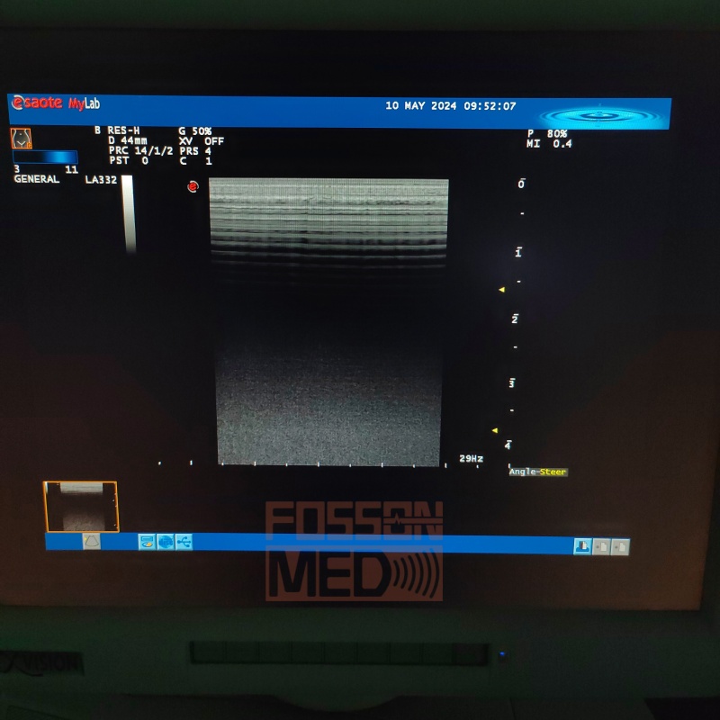 Compatible New Esaote LA332 Linear Ultrasound Probe for mylab 20 mylab 25 mylab 30 mylab 50 mylab 60 mylab 70-FOSSONMED