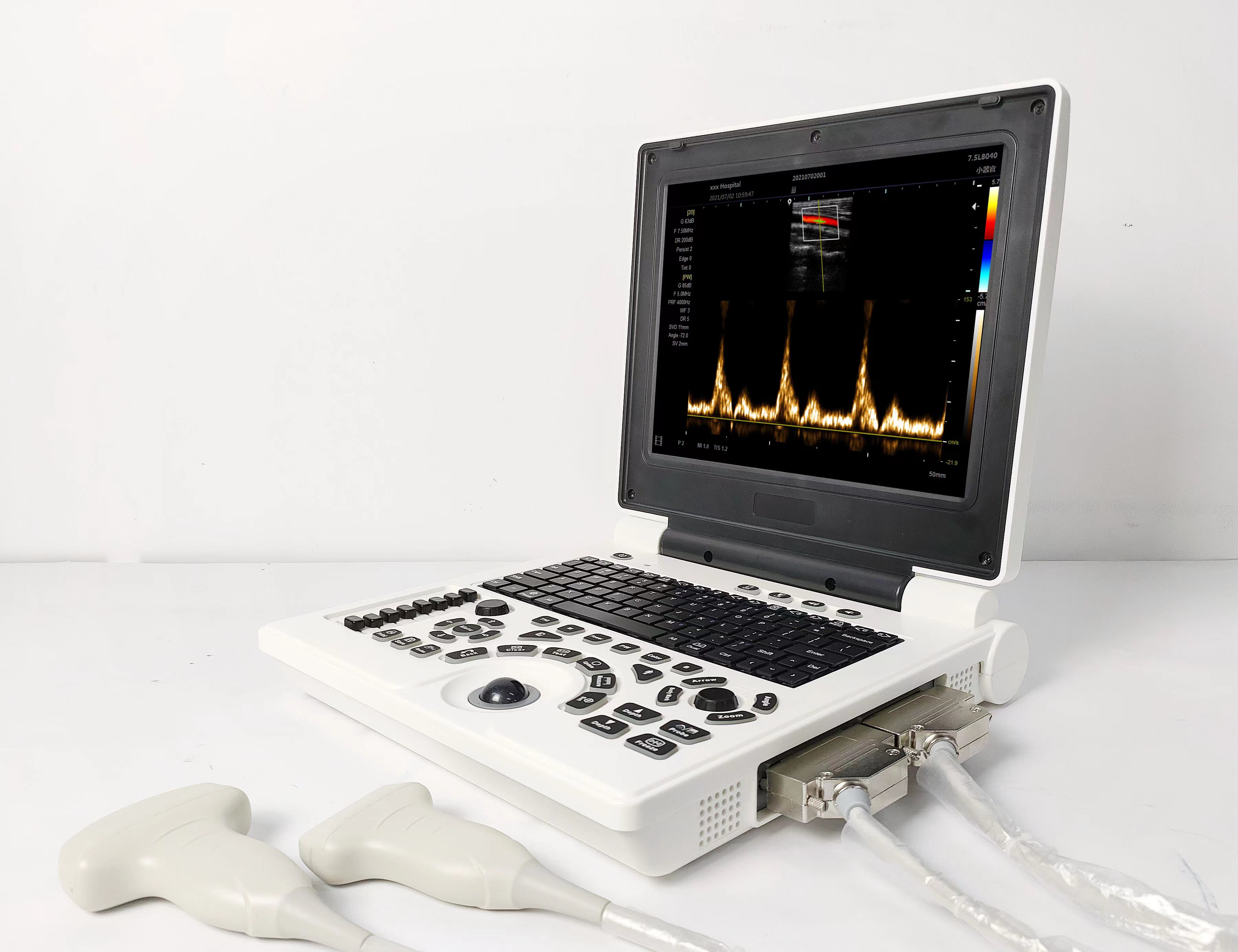 Color Doppler Portable Ultrasound System With 2 Probes for Cardiac , Abdominal , OB/GYN , Small Organ , Thyroid , Breast Applications