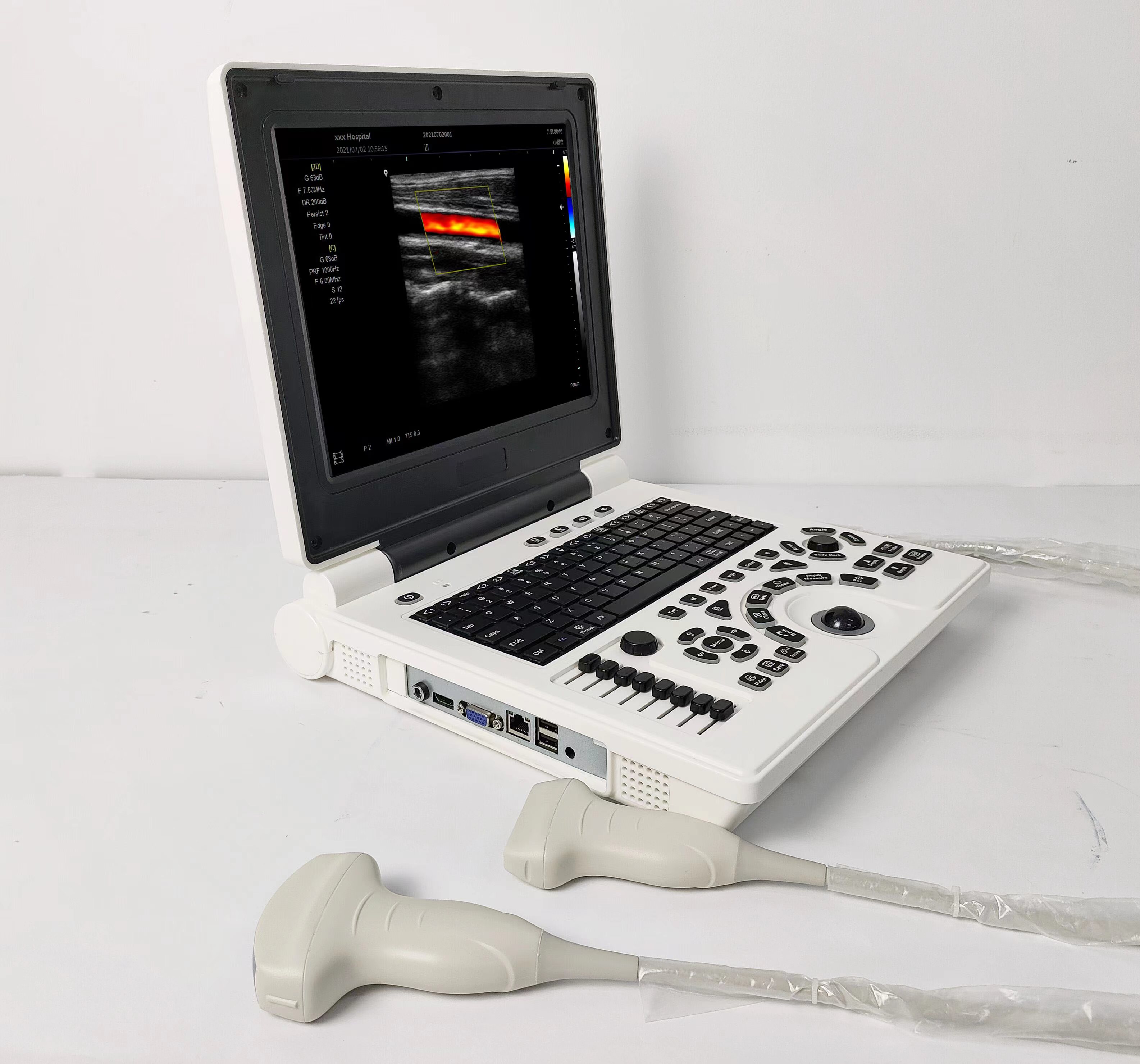 Color Doppler Portable Ultrasound System With 2 Probes for Cardiac , Abdominal , OB/GYN , Small Organ , Thyroid , Breast Applications