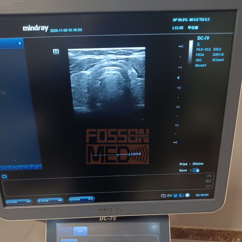 Original Used Mindray L12-3E Linear Array Ultrasound Transducer Probe for DC-8.DC-70.DC-80.DC-90.DC-8 EXP.DC-80A