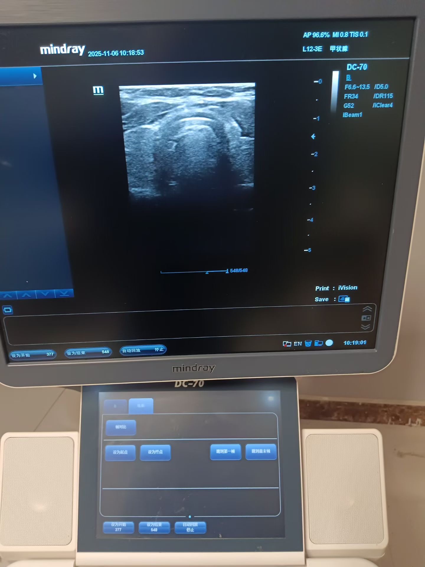 Original Used Mindray L12-3E Linear Array Ultrasound Transducer Probe for DC-8.DC-70.DC-80.DC-90.DC-8 EXP.DC-80A