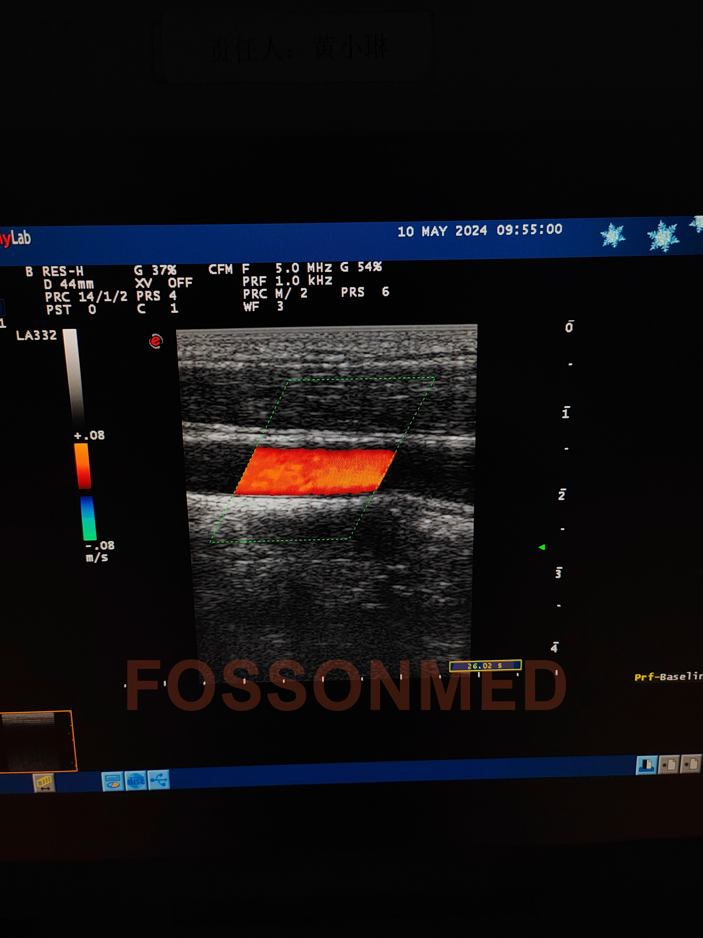 Compatible New LA332 Linear Ultrasound Probe for Esaote mylab 20 / mylab 25 / mylab 30 / mylab 50 / mylab 60 / mylab 70