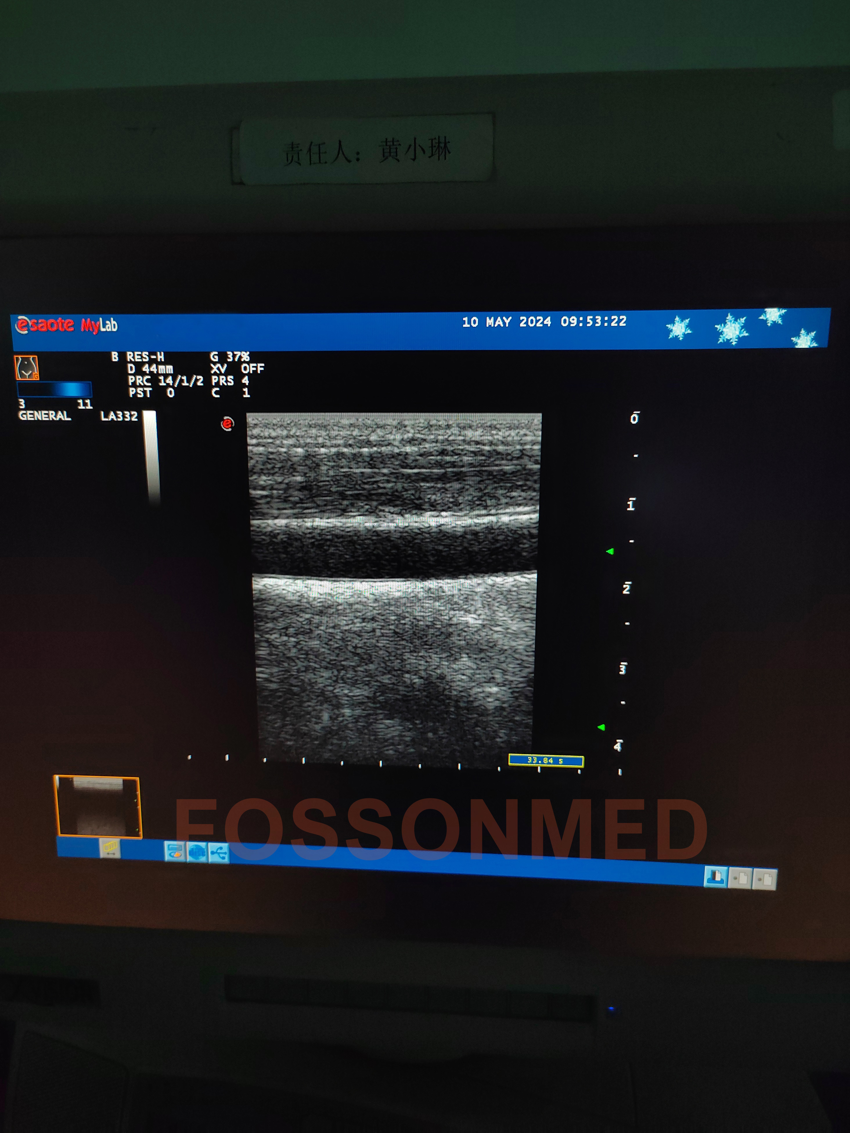 Compatible New LA332 Linear Ultrasound Probe for Esaote mylab 20 / mylab 25 / mylab 30 / mylab 50 / mylab 60 / mylab 70