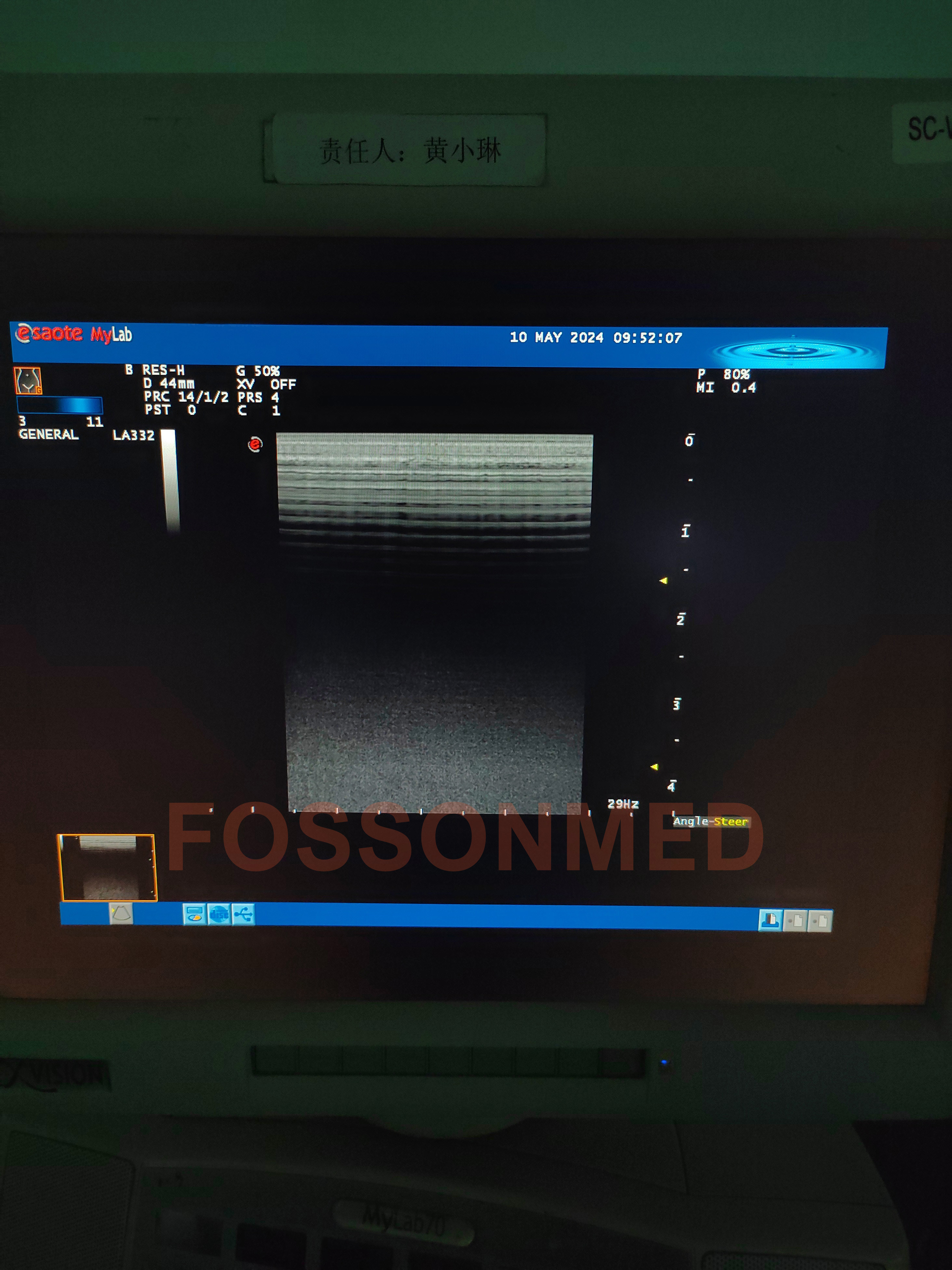 Compatible New LA332 Linear Ultrasound Probe for Esaote mylab 20 / mylab 25 / mylab 30 / mylab 50 / mylab 60 / mylab 70