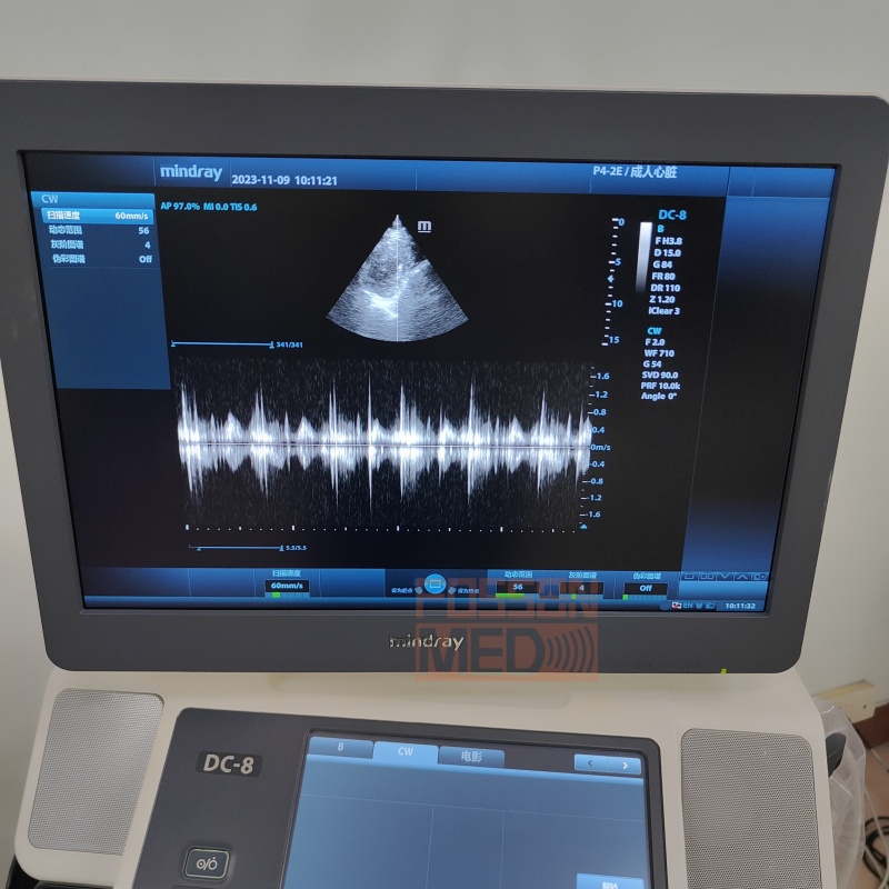 Original Used Mindray P4-2E Cardiac Phased Array Ultrasound Transducer Probe for DC-8.DC-70.DC-8EXP