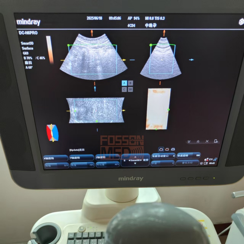 Original Used Mindray 4CD4 3D/4D Volume Convex Array Ultrasound Transducer Probe for DC-N6.DC-N6pro.DC-T6.DC-7