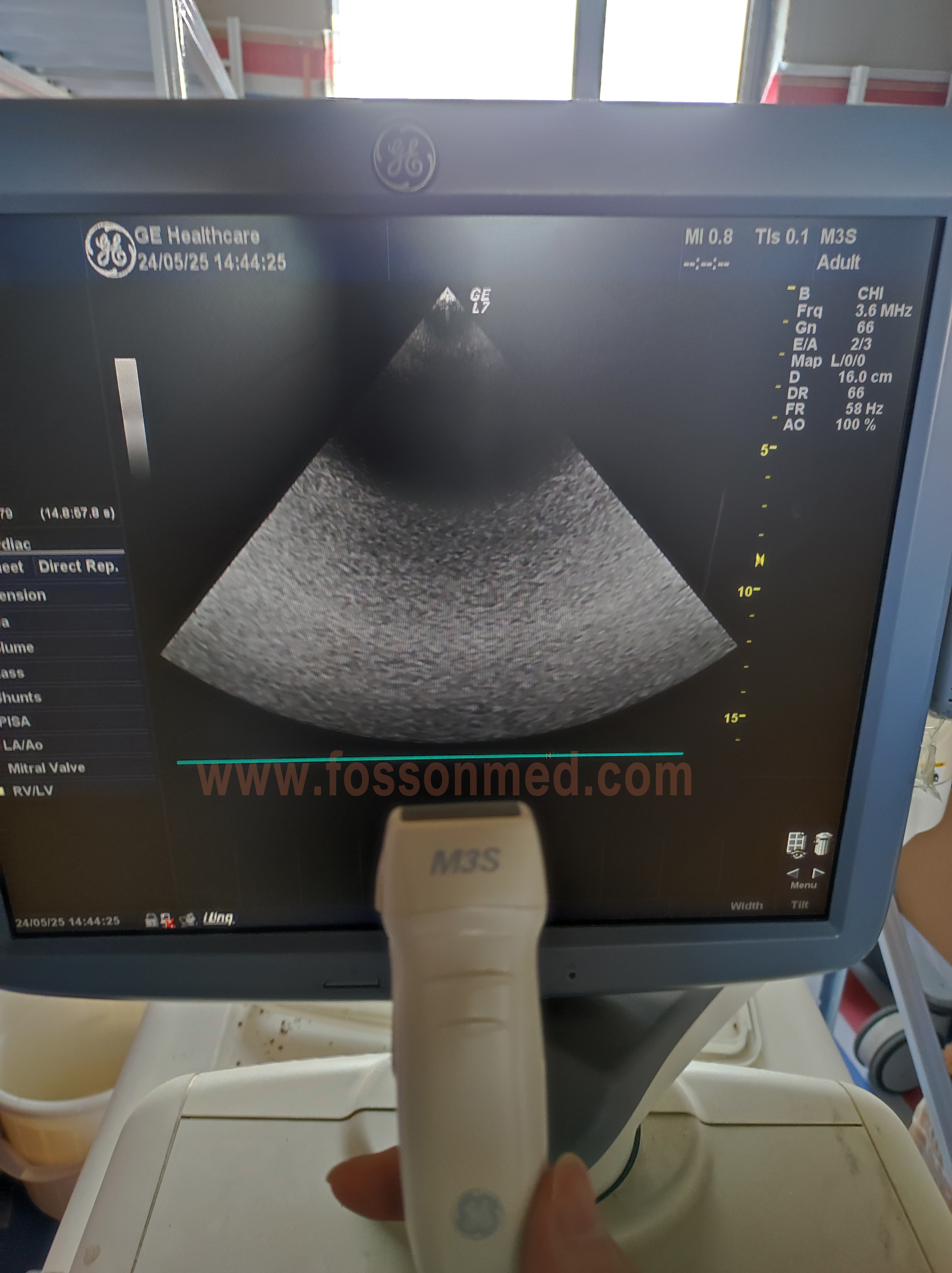 Original Used GE M3S Cardiac Phased Array Ultrasound Transducer Probe for Vivid 7