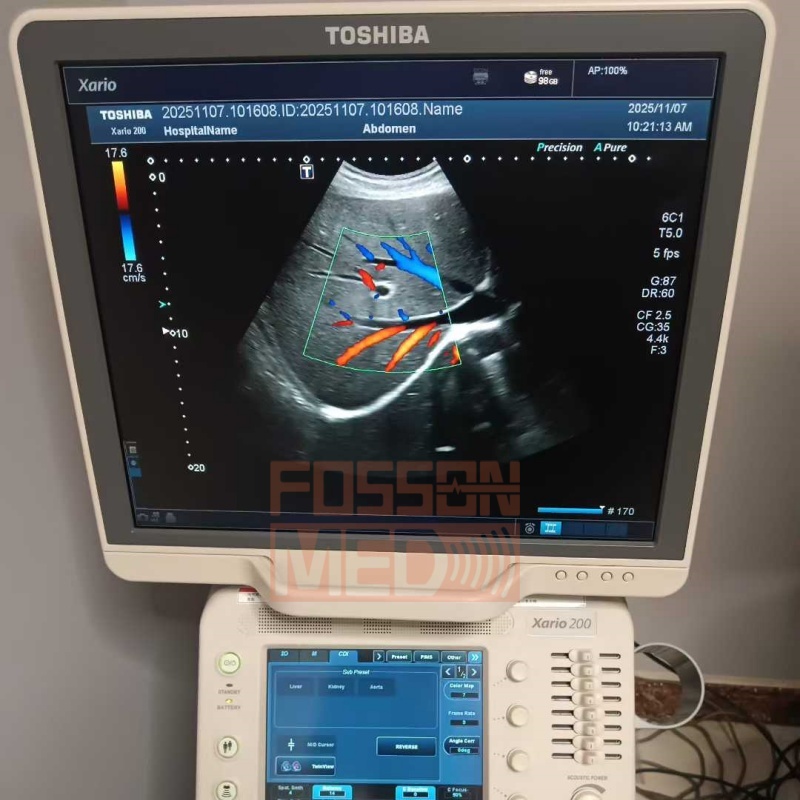 Original Used Canon Toshiba PVU-375BT 6C1 Convex Array Ultrasound Transducer Probe for Xario 100 Xario 200