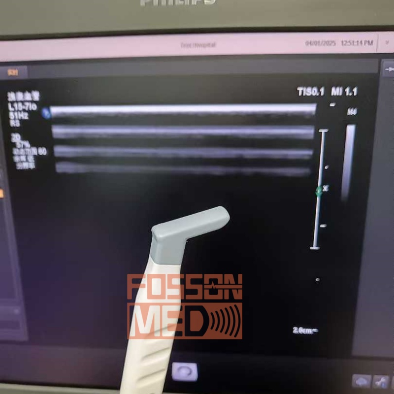  Original Used Philips L15-7io Linear Array Ultrasound Transducer Probe for Affiniti 70 EPIQ 7 