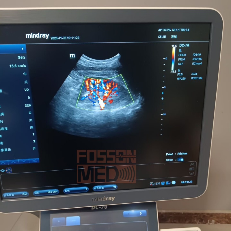 Original Used Mindray C5-2E Convex Array Ultrasound Transducer Probe for DC-8.DC-70.DC-8 EXP