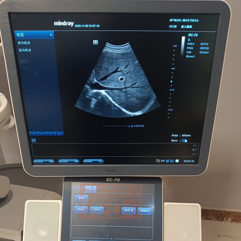 Original Used Mindray C5-2E Convex Array Ultrasound Transducer Probe for DC-8.DC-70.DC-8 EXP