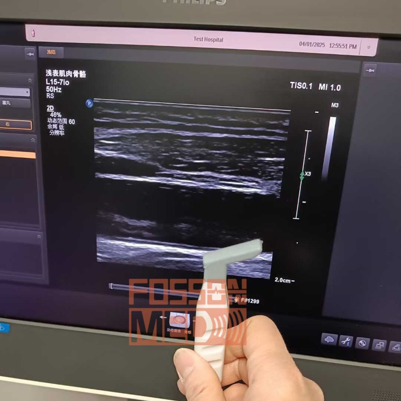  Original Used Philips L15-7io Linear Array Ultrasound Transducer Probe for Affiniti 70 EPIQ 7 