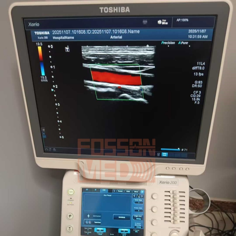 Original Used Canon Toshiba PLU-704BT 11L4 Linear Array Ultrasound Transducer Probe for Xario 100 Xario 200