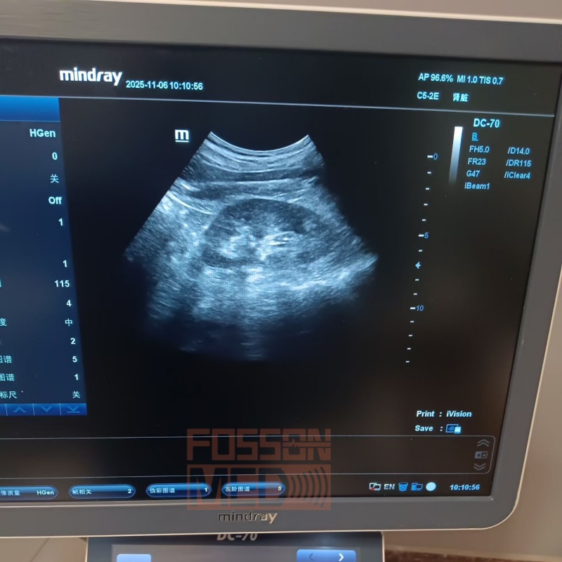 Original Used Mindray C5-2E Convex Array Ultrasound Transducer Probe for DC-8.DC-70.DC-8 EXP