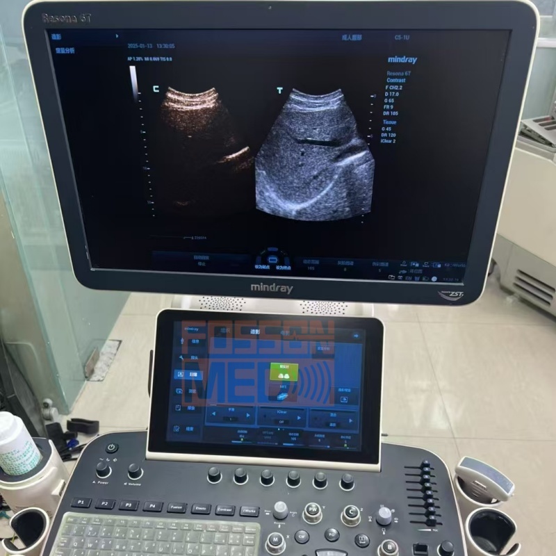 Original Used Mindray C5-1U Convex Array Ultrasound Transducer Probe for Resona 6.Resona 7.Resona R9.Resona T6