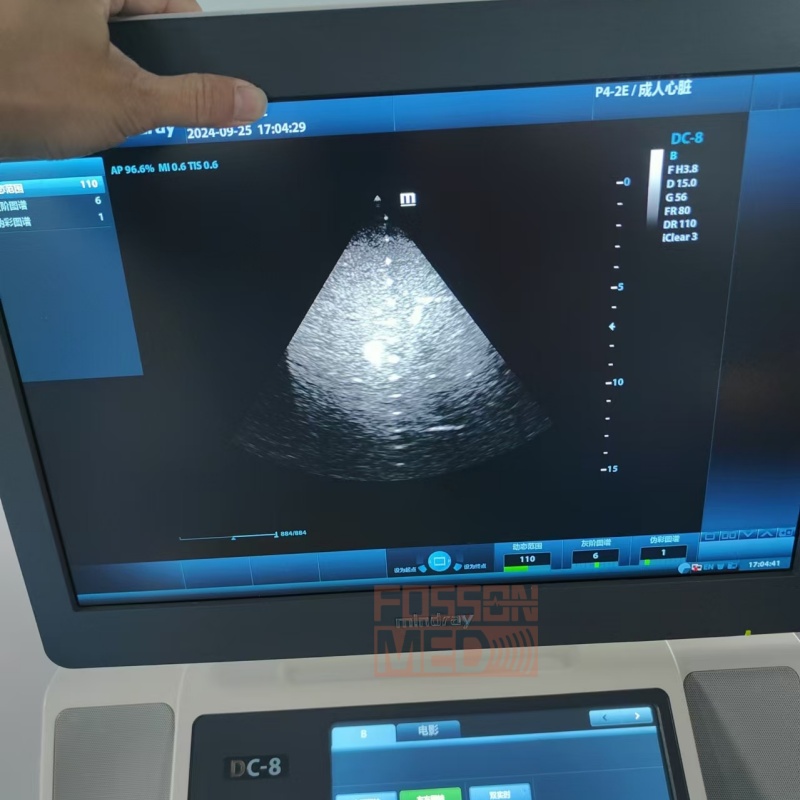 Original Used Mindray P4-2E Cardiac Phased Array Ultrasound Transducer Probe for DC-8.DC-70.DC-8EXP