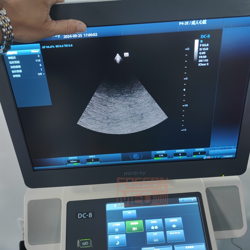 Original Used Mindray P4-2E Cardiac Phased Array Ultrasound Transducer Probe for DC-8.DC-70.DC-8EXP