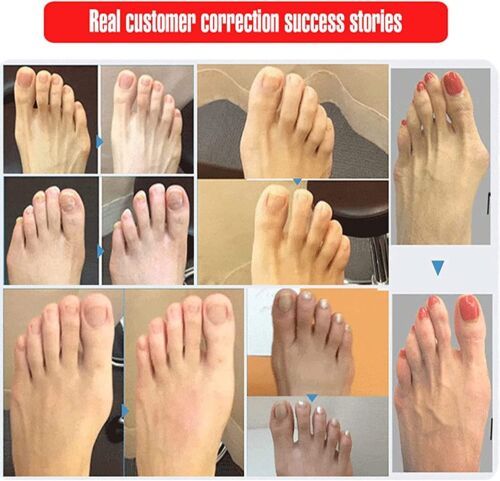 Bohemian Fashion Non-Slip Orthopedic Sandals