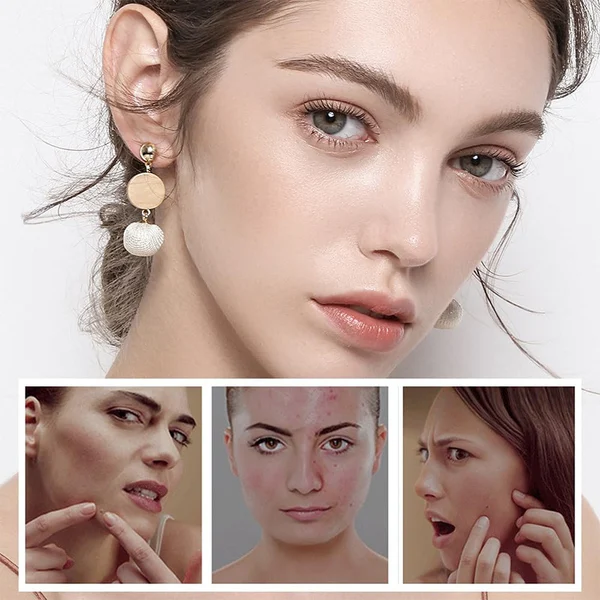 🔥Last Day Special Sale 49%-Vitamin C Facial Serum-Festivesl