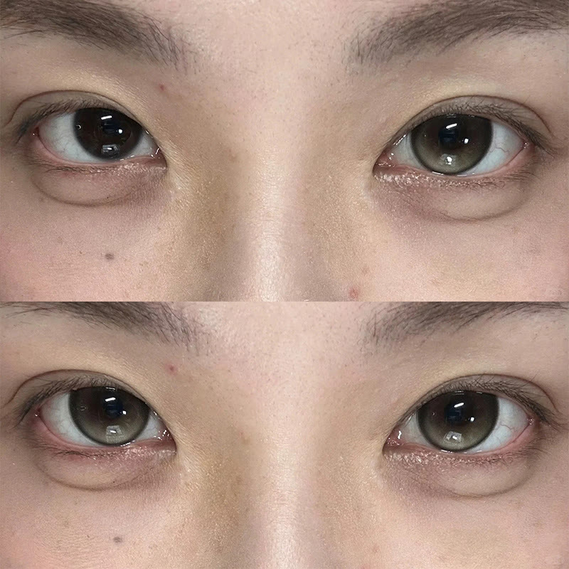 MYEYEBB Aura Tint Brown Colored Contact Lenses | 6 Months - image 4