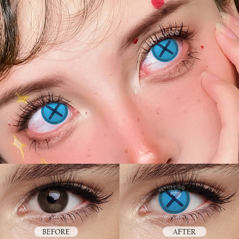 MYEYEBB Blind Button Eye Blue Cosplay Colored Contact Lenses-MYEYEBB