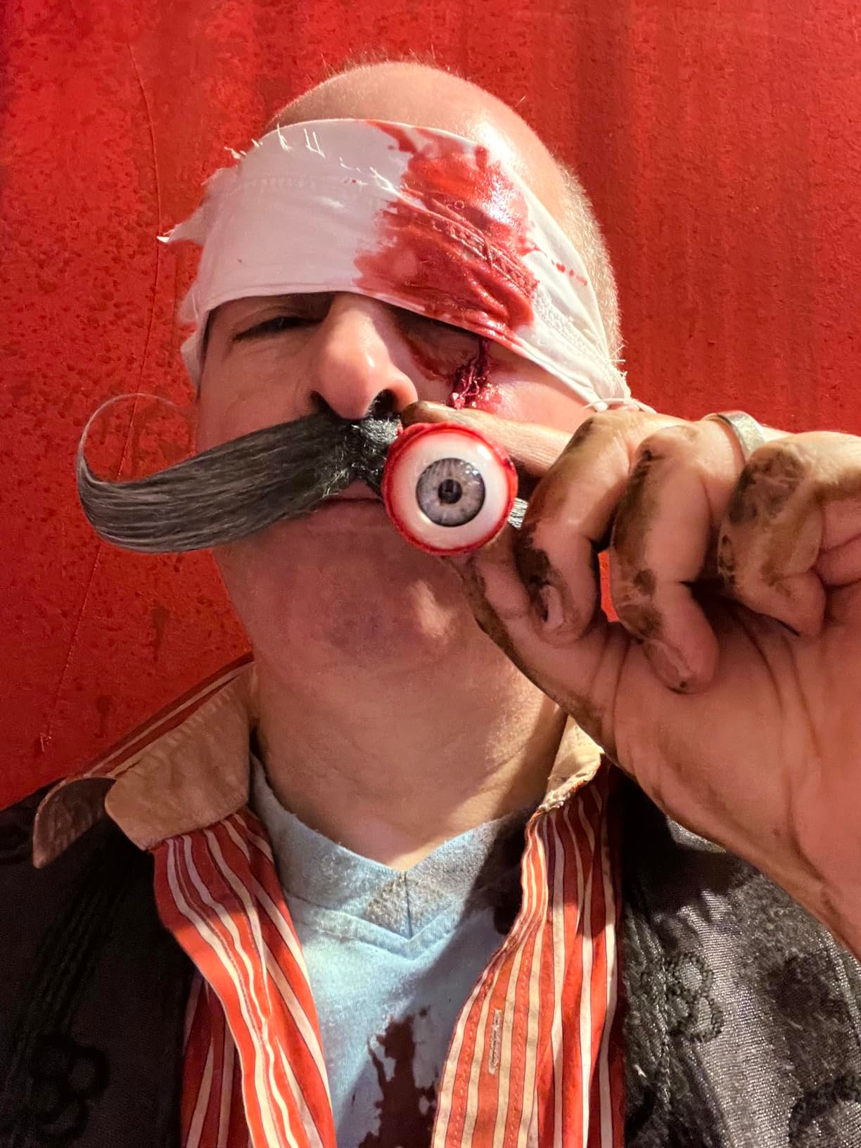 What happened to your eye?!?