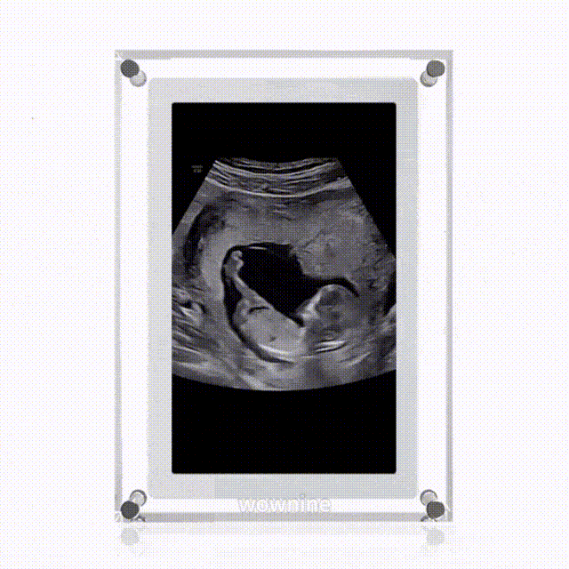 WOWNINE™ Digital Frame