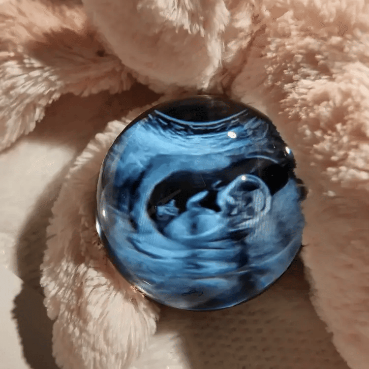 Memory Orb™