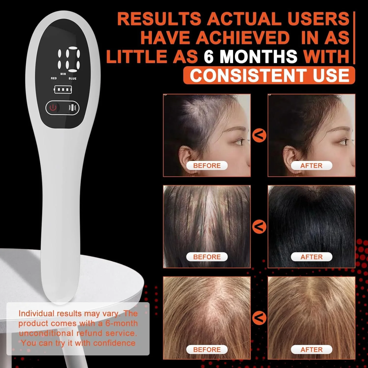 Laser Hair Growth Comb for Hair Regrowth and Hair Loss Treatment