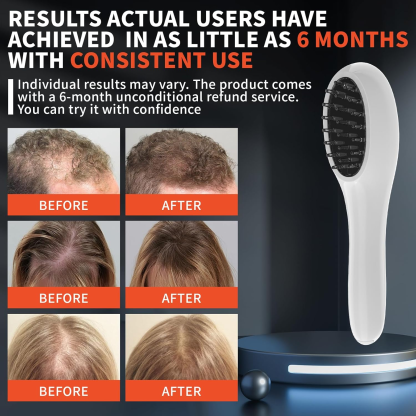 Laser Hair Growth Comb for Hair Regrowth and Hair Loss Treatment